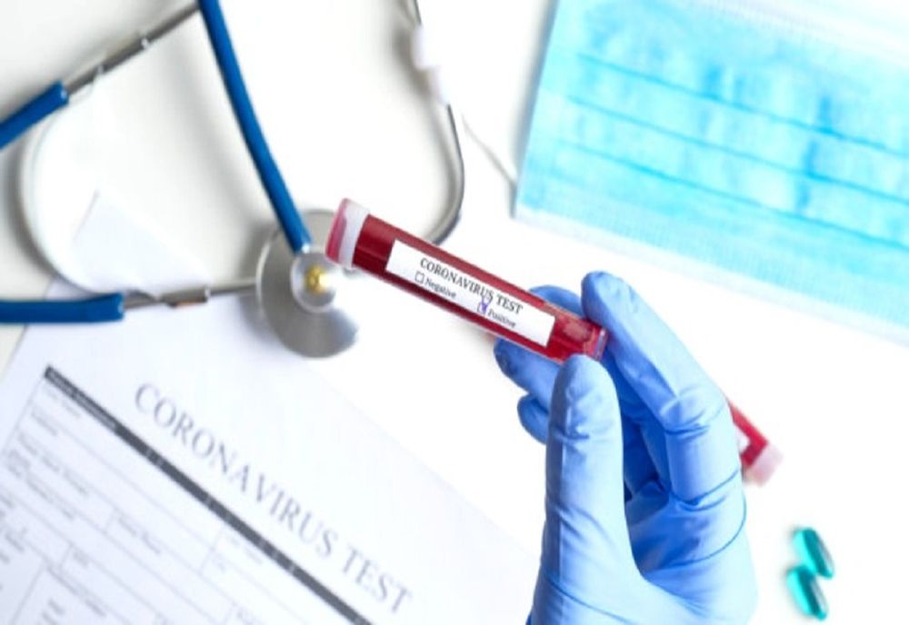 23 de noi cazuri de coronavirus în Timiș, 33 în Arad, 22 în Caraș și 17 în Hunedoara. Bilanțul ultimelor 24 de ore