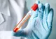 14 poliţişti din Cluj infectaţi cu coronavirus