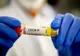 Bilanț coronavirus 30 decembrie: 1.497 cazuri noi și 37 de decese dintre care 1 anterior